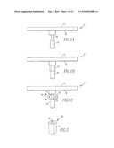 KNEE AND SHOULDER JOINT PROSTHESIS diagram and image