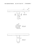 KNEE AND SHOULDER JOINT PROSTHESIS diagram and image