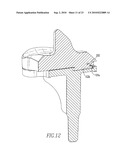 KNEE AND SHOULDER JOINT PROSTHESIS diagram and image