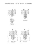 KNEE AND SHOULDER JOINT PROSTHESIS diagram and image