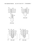 KNEE AND SHOULDER JOINT PROSTHESIS diagram and image