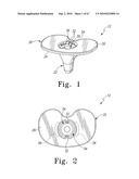 MOBILE/FIXED PROSTHETIC KNEE SYSTEMS diagram and image