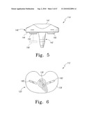 MOBILE/FIXED PROSTHETIC KNEE SYSTEMS diagram and image