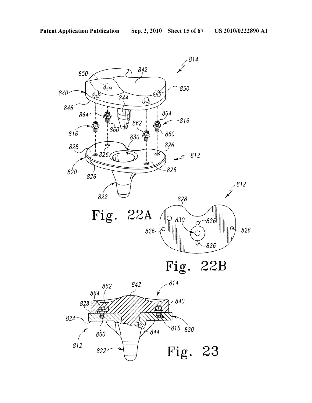 MOBILE/FIXED PROSTHETIC KNEE SYSTEMS - diagram, schematic, and image 16