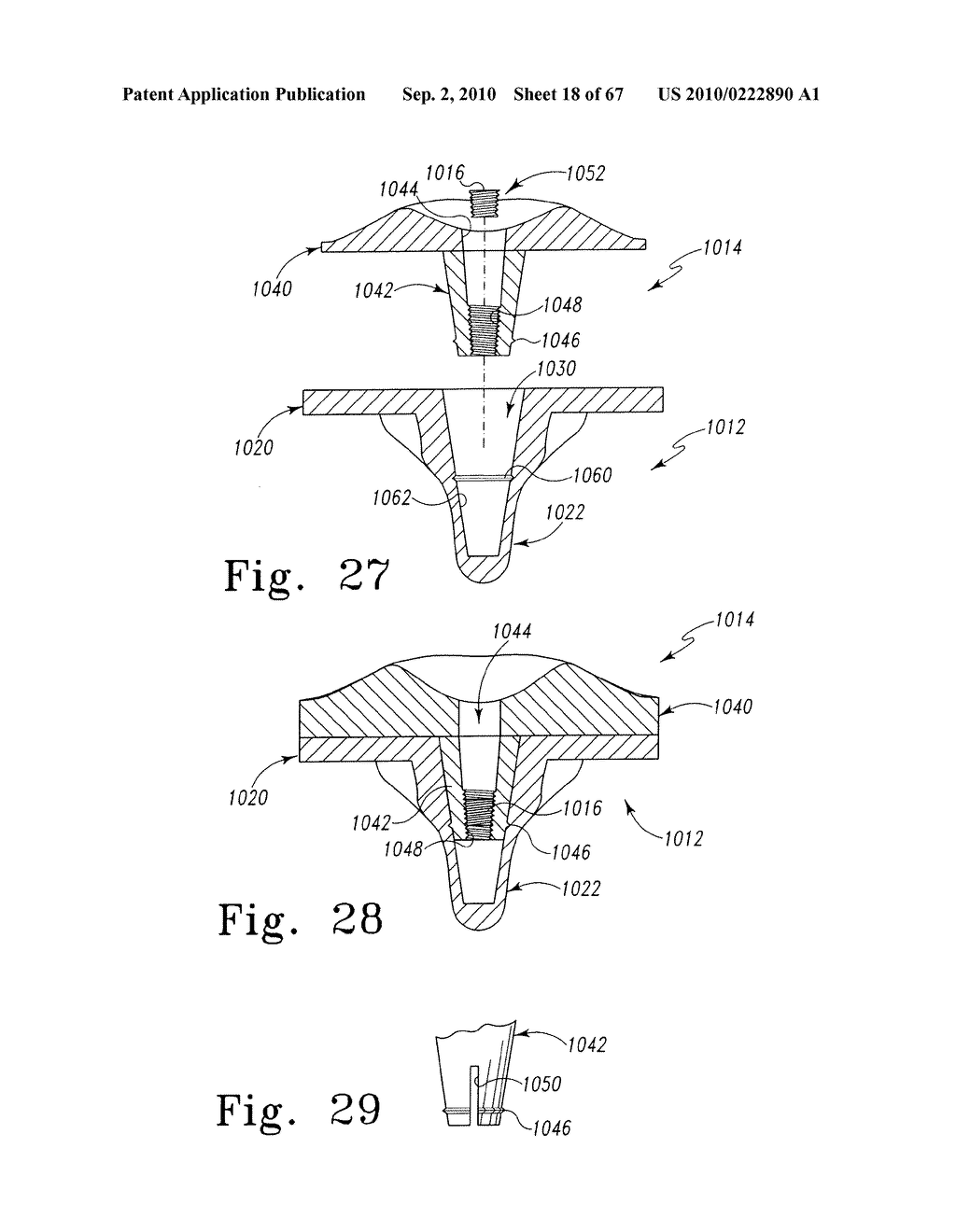 MOBILE/FIXED PROSTHETIC KNEE SYSTEMS - diagram, schematic, and image 19