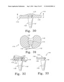 MOBILE/FIXED PROSTHETIC KNEE SYSTEMS diagram and image