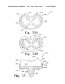 MOBILE/FIXED PROSTHETIC KNEE SYSTEMS diagram and image