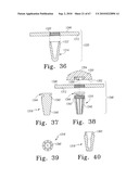 MOBILE/FIXED PROSTHETIC KNEE SYSTEMS diagram and image