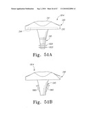 MOBILE/FIXED PROSTHETIC KNEE SYSTEMS diagram and image