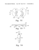 MOBILE/FIXED PROSTHETIC KNEE SYSTEMS diagram and image