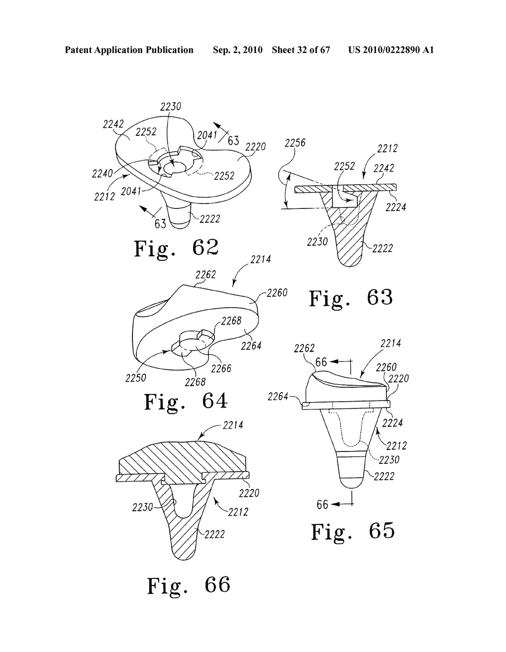 MOBILE/FIXED PROSTHETIC KNEE SYSTEMS - diagram, schematic, and image 33