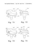 MOBILE/FIXED PROSTHETIC KNEE SYSTEMS diagram and image