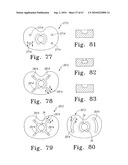 MOBILE/FIXED PROSTHETIC KNEE SYSTEMS diagram and image