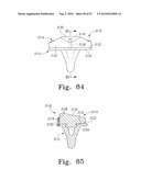 MOBILE/FIXED PROSTHETIC KNEE SYSTEMS diagram and image