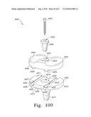 MOBILE/FIXED PROSTHETIC KNEE SYSTEMS diagram and image