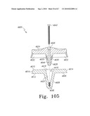 MOBILE/FIXED PROSTHETIC KNEE SYSTEMS diagram and image