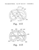 MOBILE/FIXED PROSTHETIC KNEE SYSTEMS diagram and image