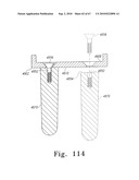 MOBILE/FIXED PROSTHETIC KNEE SYSTEMS diagram and image