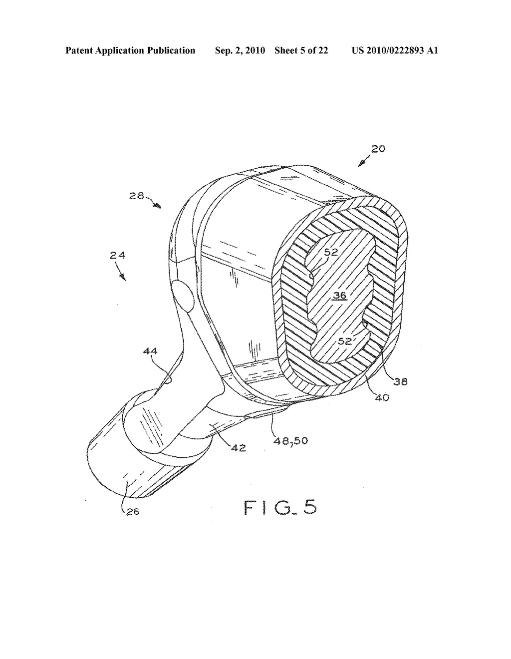 PROSTHETIC HIP IMPLANTS - diagram, schematic, and image 06