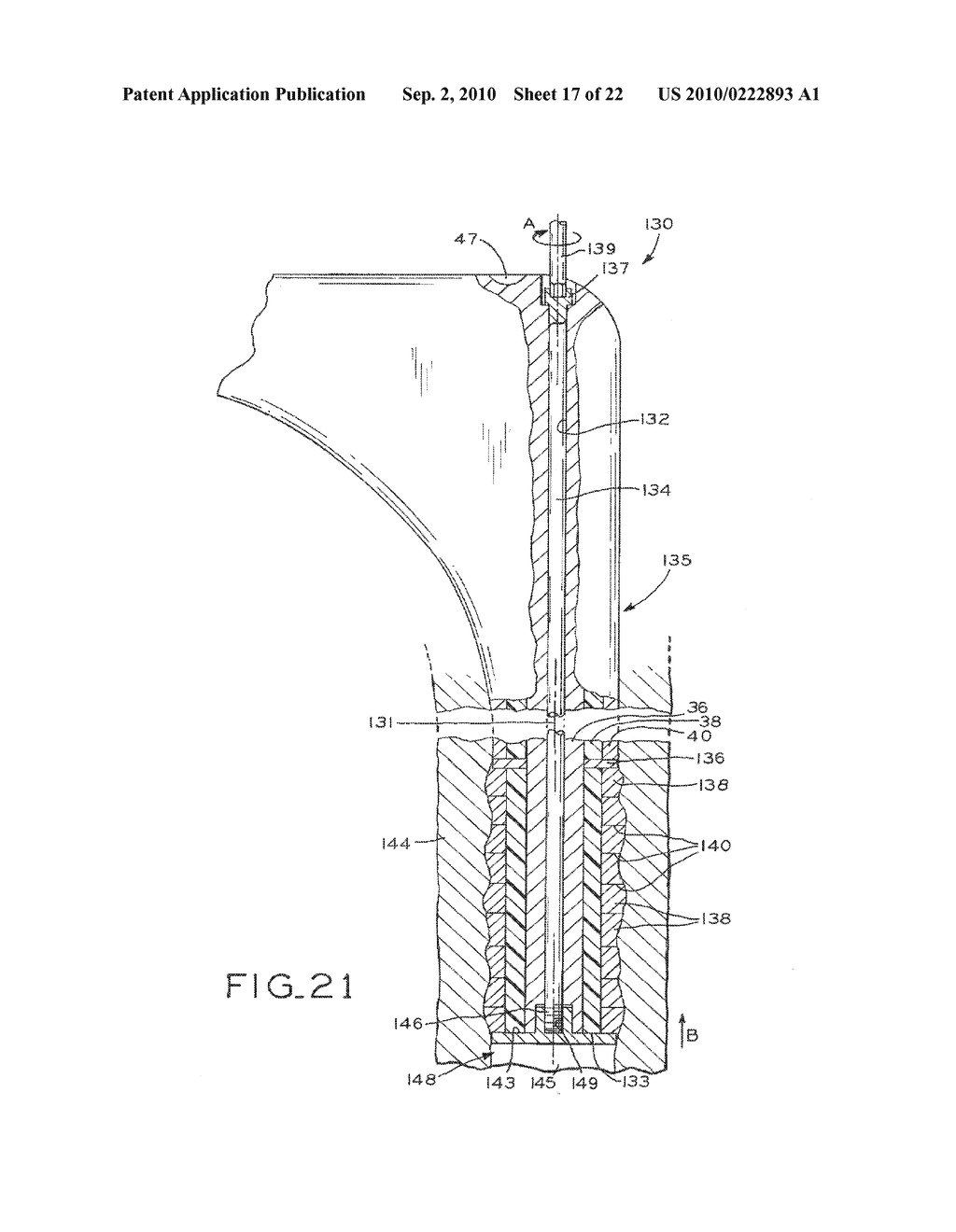 PROSTHETIC HIP IMPLANTS - diagram, schematic, and image 18