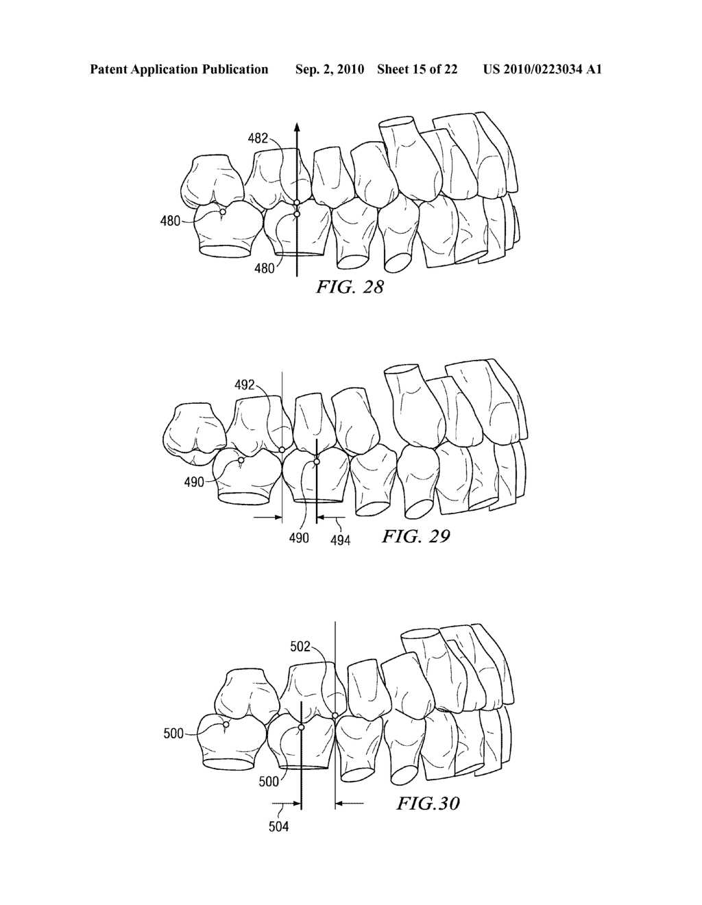 METHOD AND SYSTEM FOR ENHANCED ORTHODONTIC TREARMENT PLENNING - diagram, schematic, and image 16