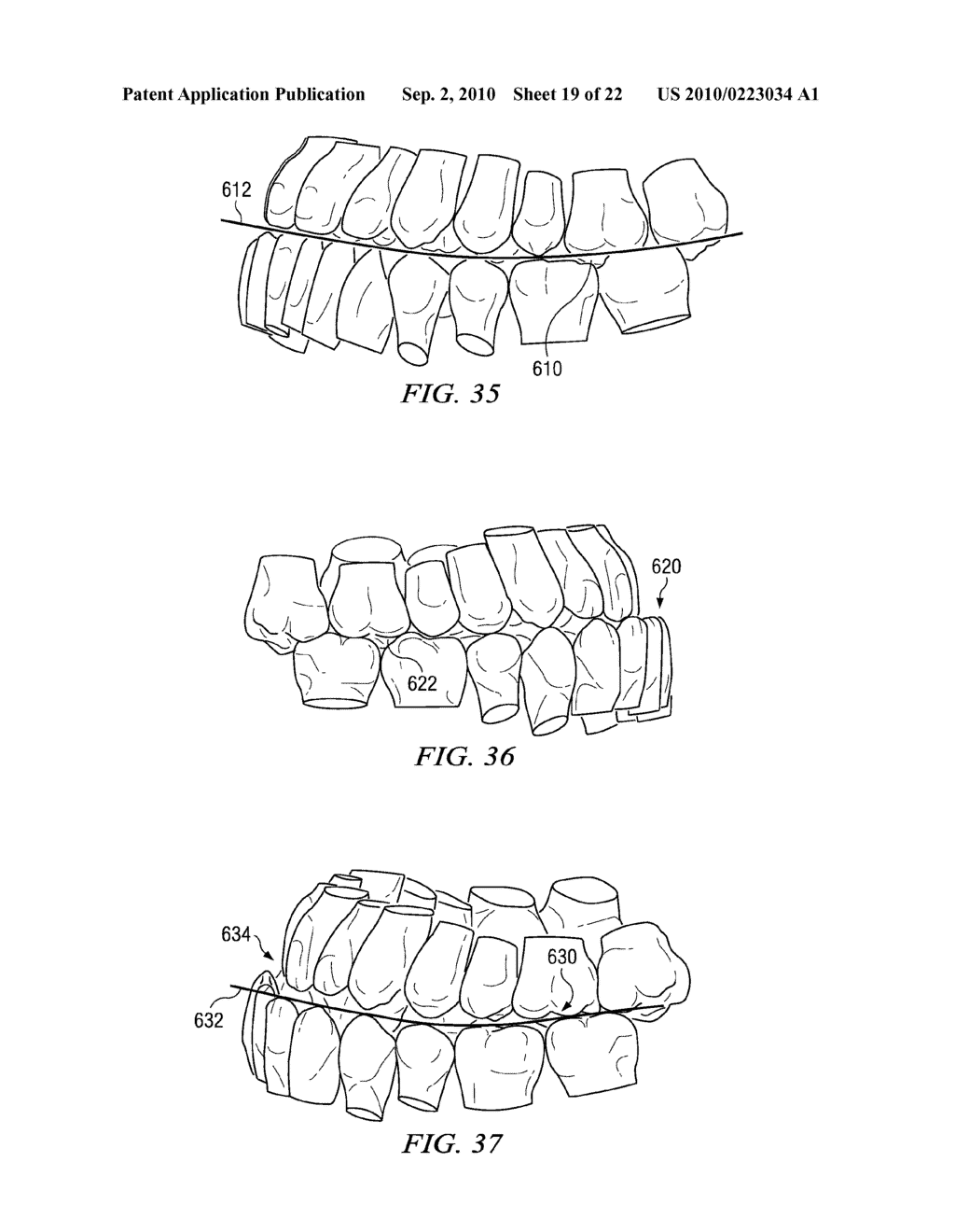 METHOD AND SYSTEM FOR ENHANCED ORTHODONTIC TREARMENT PLENNING - diagram, schematic, and image 20