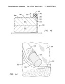 FLEXIBLE SYSTEM FOR SURROUNDING A PERIMETER AND COVERING A TOP SURFACE OF A MATTRESS diagram and image