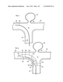 ENDOVASCULAR PROSTHESIS diagram and image