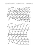 ENDOVASCULAR PROSTHESIS diagram and image