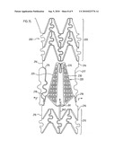 ENDOVASCULAR PROSTHESIS diagram and image