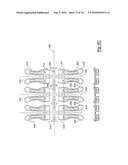 SUSPENSION SYSTEM FOR A VEHICLE AND METHOD diagram and image