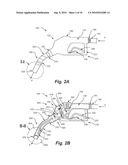 Fuel Leak Prevention System diagram and image