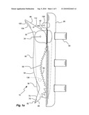 WEARABLE, SELF-DEPLOYING FALL ARREST DEVICE diagram and image