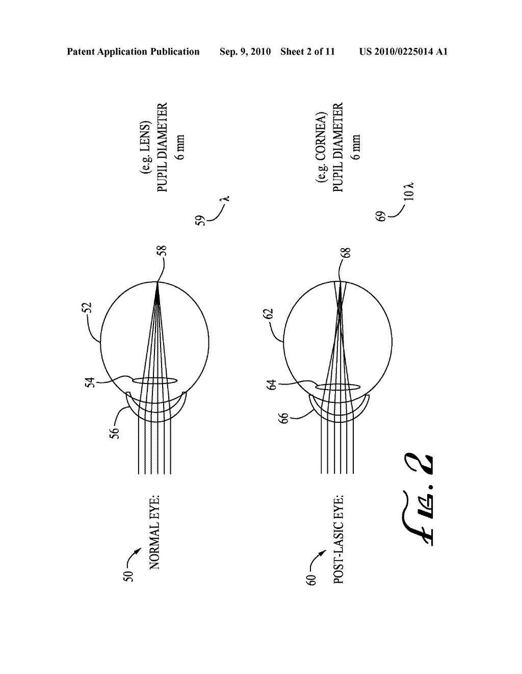 SYSTEM FOR CHARACTERIZING A CORNEA AND OBTAINING AN OPTHALMIC LENS - diagram, schematic, and image 03