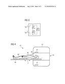 RF STRIPLINE ANTENNA WITH IMPEDANCE ADAPTATION FOR MR IMAGING diagram and image