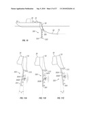 MARINE SEISMIC SURVEYING IN ICY OR OBSTRUCTED WATERS diagram and image