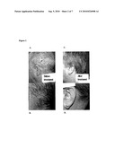 COMPOSITIONS FOR PROMOTING WOUND HEALING AND TREATING PSORIASIS diagram and image