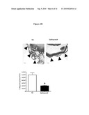 COMPOSITIONS AND METHODS FOR TREATING OCULAR DISEASES AND CONDITIONS diagram and image