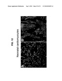 Direct Oxidation of Calcium/Calmodulin Dependent Protein Kinase II and Associated Diagnostic and Therapeutic Methods diagram and image