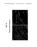 Direct Oxidation of Calcium/Calmodulin Dependent Protein Kinase II and Associated Diagnostic and Therapeutic Methods diagram and image