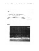 ULTRASOUND-ENHANCED INTRASCLERAL DELIVERY OF MACROMOLECULES diagram and image