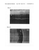 ULTRASOUND-ENHANCED INTRASCLERAL DELIVERY OF MACROMOLECULES diagram and image