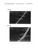 ULTRASOUND-ENHANCED INTRASCLERAL DELIVERY OF MACROMOLECULES diagram and image