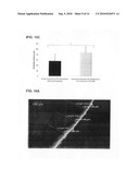 ULTRASOUND-ENHANCED INTRASCLERAL DELIVERY OF MACROMOLECULES diagram and image