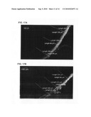 ULTRASOUND-ENHANCED INTRASCLERAL DELIVERY OF MACROMOLECULES diagram and image