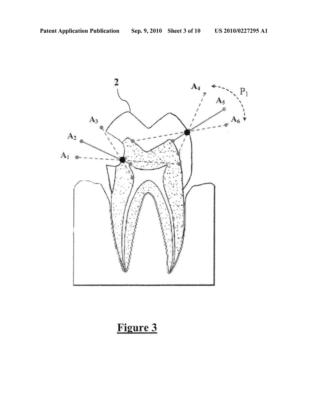 ULTRASONIC DEVICE FOR ASSESSMENT OF INTERNAL TOOTH STRUCTURE - diagram, schematic, and image 04