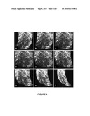 MINERALIZED THREE-DIMENSIONAL BONE CONSTRUCTS diagram and image