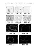 METHODS FOR REGULATING ANGIOGENESIS AND VASCULAR INTEGRITY USING TRK RECEPTOR LIGANDS diagram and image