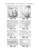 METHODS FOR REGULATING ANGIOGENESIS AND VASCULAR INTEGRITY USING TRK RECEPTOR LIGANDS diagram and image