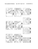 METHODS FOR REGULATING ANGIOGENESIS AND VASCULAR INTEGRITY USING TRK RECEPTOR LIGANDS diagram and image